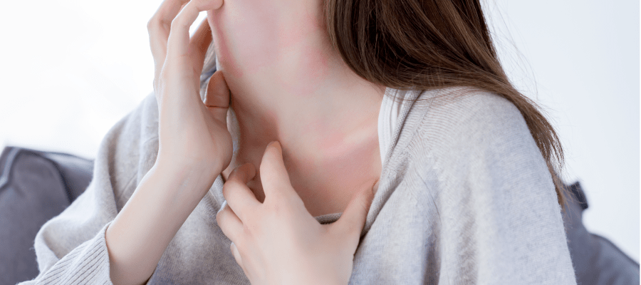 Alergiczne zapalenie skóry jak pokonać